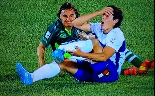 Marko biskupovic, defensor de la universidad Católica tuvo fractura tras la dura entreda del delantero de santiago wanderers