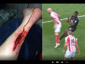 Esto le hizo Maynor Figueroa a Ireland