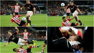 Así le quedó la pierna a Luke Shaw