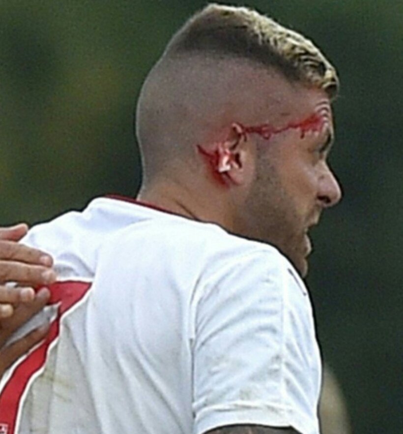 jeremy menez con sangre en la oreja tras un pisioton de un rival con el bordeaux
