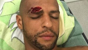 Felipe Melo después del golpe