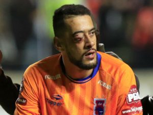 Así quedó el arquero de Paraná, Leó, luego del choque con Fred previo al gol del delantero por la Copa de Brasil