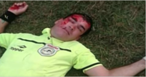 Árbitro herido en el fútbol paraguayo