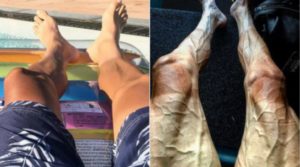 piernas con venas de ciclista profesional tras la etapa 16 del tour de francia 2017 Bora Hansgrohe Paweł Poljański