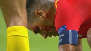 Falcao corte cabeza