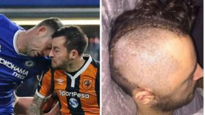 Ryan Mason, jugador del Hull City de 26 años, dice adiós al fútbol debido al brutal cabezazo con Gary Cahill