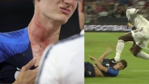 Así quedó el cuello del francés Pavard tras pisotón de de Alemania