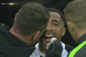 Callum Wilson por poco pierde su diente en el partido del Newcastle vs Arsenal.